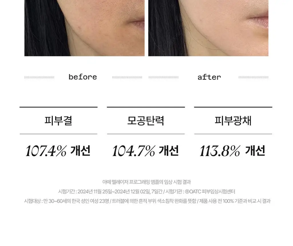 [미백앰플] 아떼 멜레이저 프로그래밍 앰플 10ml 5+1 상세페이지 36